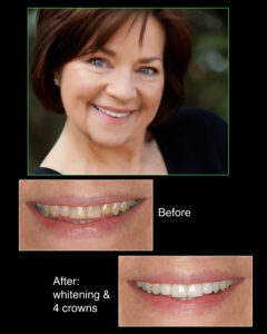 Denver Dentist Headshots Composite