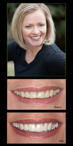 Denver Dentist Headshot Photography Composite